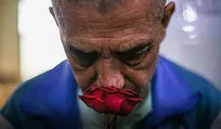 هزینه دندانپزشکی جانبازان اعصاب و روان توسط سازمان پرداخت شد